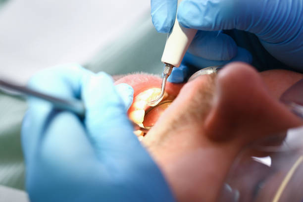 Best Broken or Cracked Tooth Emergency Dentist in Bronxville, NY